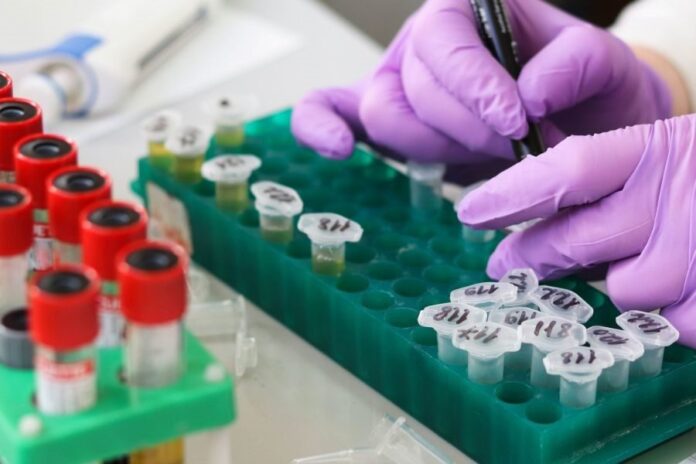 Hallazgo de biomarcadores anticipa diabetes tipo 2 siete años antes