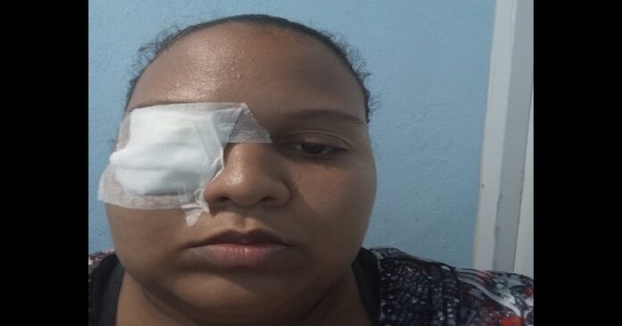Joven pide ayuda para prótesis ocular