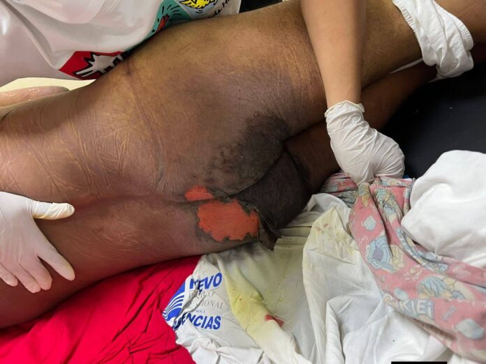Denuncia revive fantasmas de tortura en cuartel policial de Moca