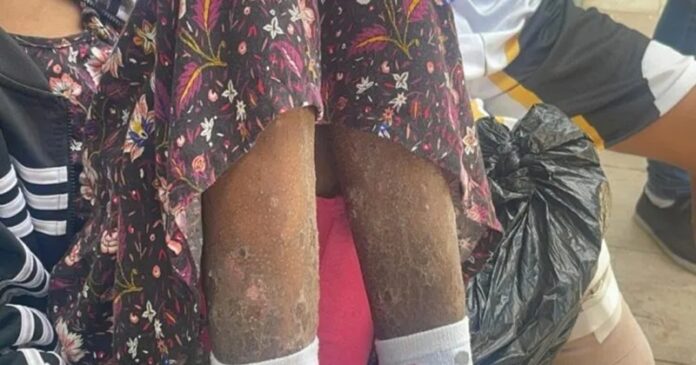 Niña con extraña enfermedad espera por horas atención en hospital infantil de Santiago