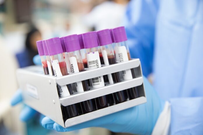 Inteligencia artificial podría predecir el riesgo de desarrollar 20 tipos de cáncer